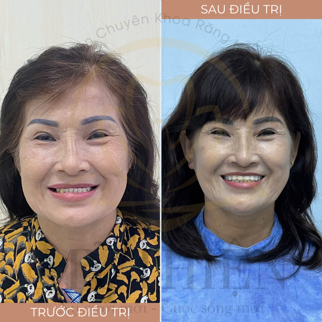 Bệnh Viện Tư Nhân Chuyên Khoa Răng Hàm Mặt Mỹ Thiện