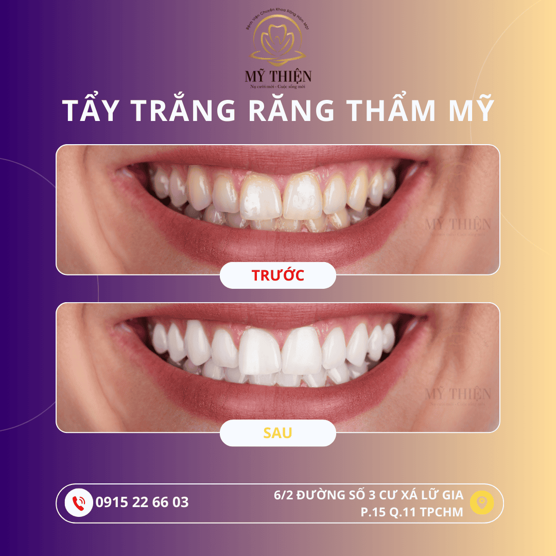 Bệnh Viện Tư Nhân Chuyên Khoa Răng Hàm Mặt Mỹ Thiện